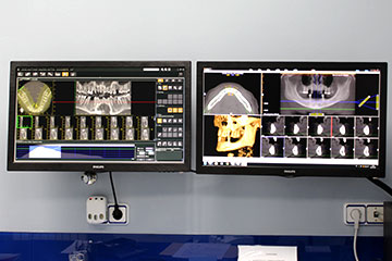 planificación Implantes clínica Rehberger López-Fanjul