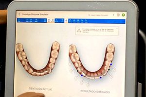 simulacion ortodoncia clinica rehberger