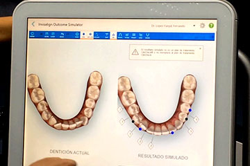 simulacion ortodoncia clinica rehberger
