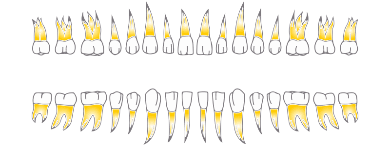 Dientes Endodoncia Oviedo Clínica Rehberger López-Fanjul