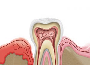 Periodoncia Clínica Rehberger López-Fanjul Oviedo