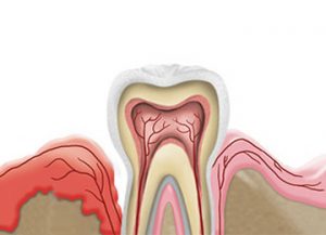 Periodoncia Clínica Rehberger López-Fanjul Oviedo