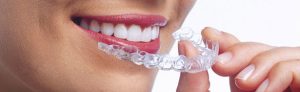 ortodoncia invisalign Clínica Dental y Maxilofacial Rehberger López-Fanjul Oviedo