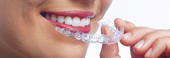 ortodoncia invisalign Clínica Dental y Maxilofacial Rehberger López-Fanjul Oviedo