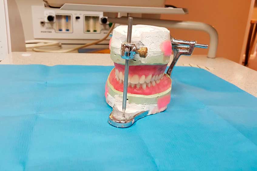 Implantes-dentales-laboratorio