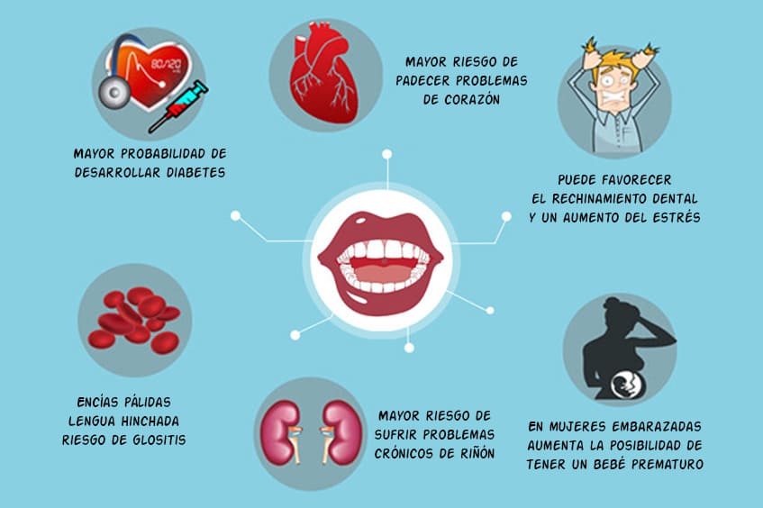 Periodontitis-consecuencias-para-el-resto-del-cuerpo-dentista-periodoncia-asturias-gijon-oviedo