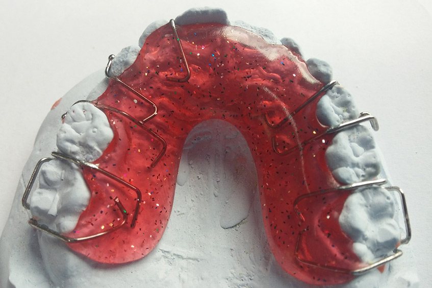 aparato-dientes-para-ortodoncia-interceptiva-clinica-dental-en-asturias