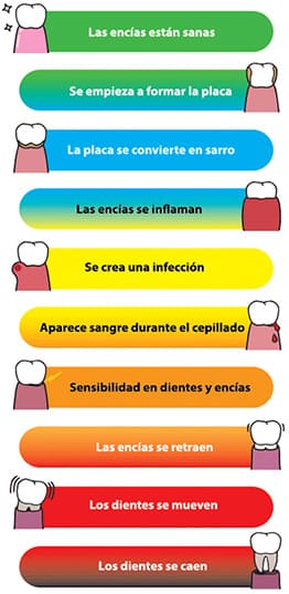 fases-enfermedad-periodontal-clinica-dental-periodoncia-asturias-gijon-oviedo