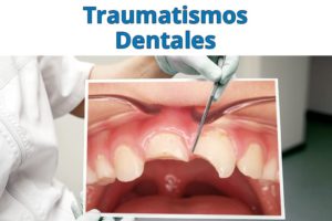 traumatismos-dentales-causas-y-consecuencias-dentista-asturias-gijon-oviedo