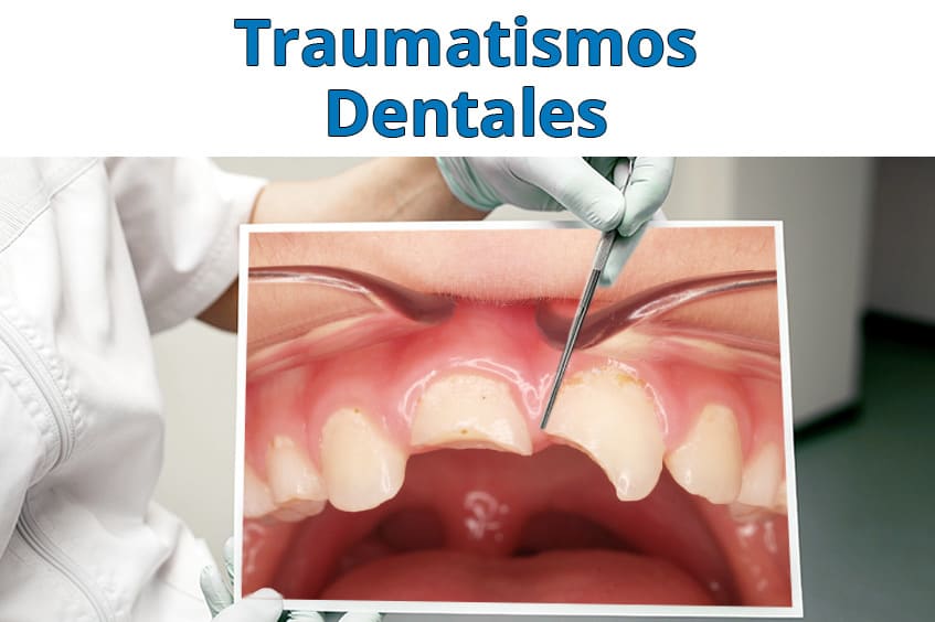 traumatismos-dentales-causas-y-consecuencias-dentista-asturias-gijon-oviedo