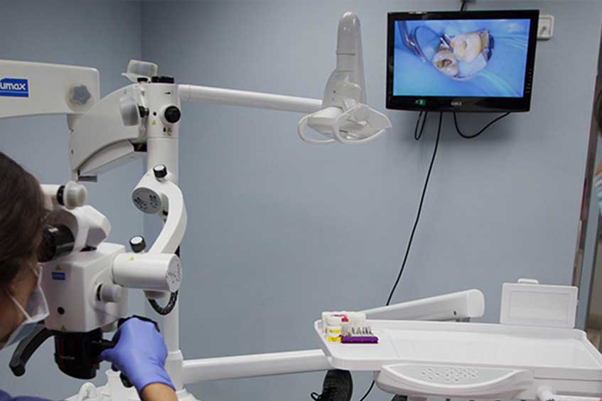 endodoncia-con-microscopio-oviedo-asturias-clinica-dental