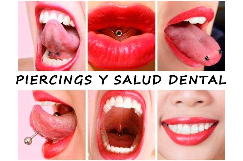 piercings-y-salud-dental