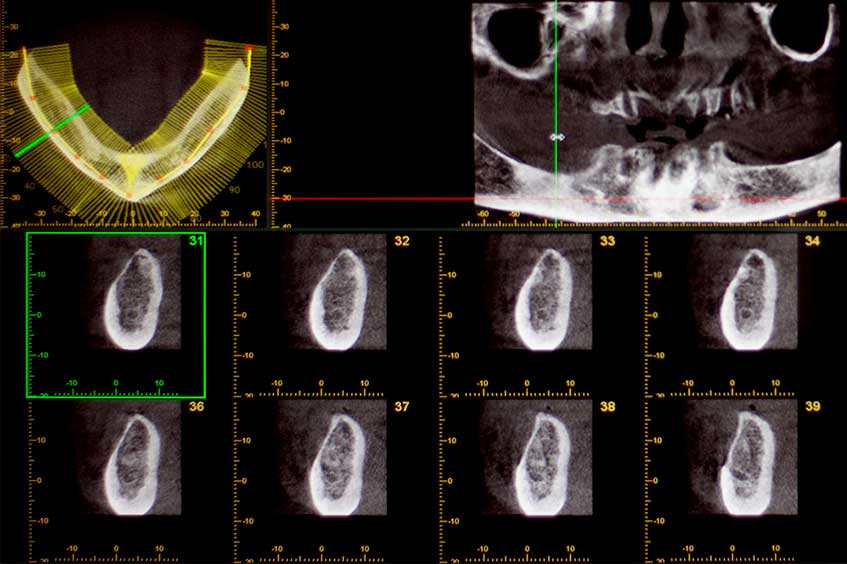 escaner-diagnostico-radiologico-dental-oviedo