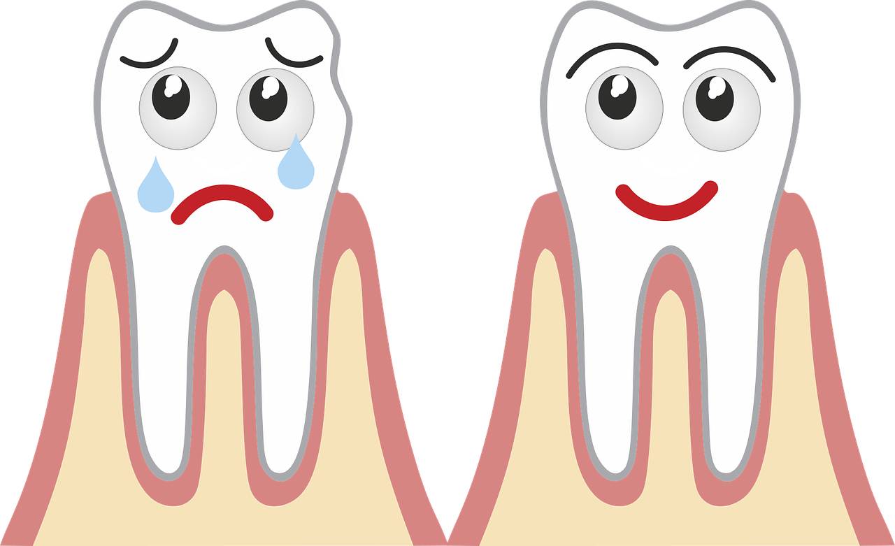 Empaste u obturación dental: Todo lo que debes saber, en esta guía