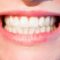 Conceptos para entender cómo es tu boca. El periodonto.
